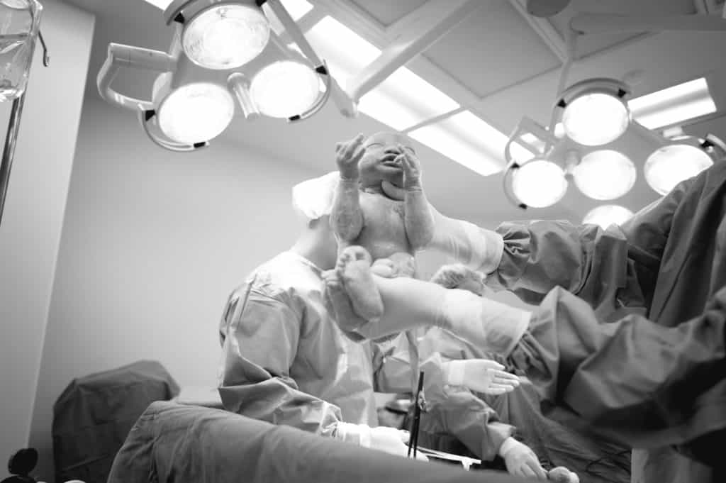 a surgeon holds up a newborn above his mother's abdomen, the mother is having a cesarean birth